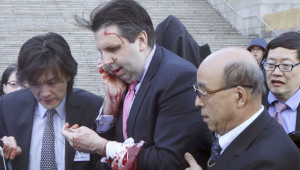 US Ambassador Mark Lippert was attacked on Thursday. (AP Photo)