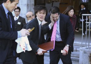 US ambassador Mark Lippert (R) was attacked in Seoul. (Reuters Photo)
